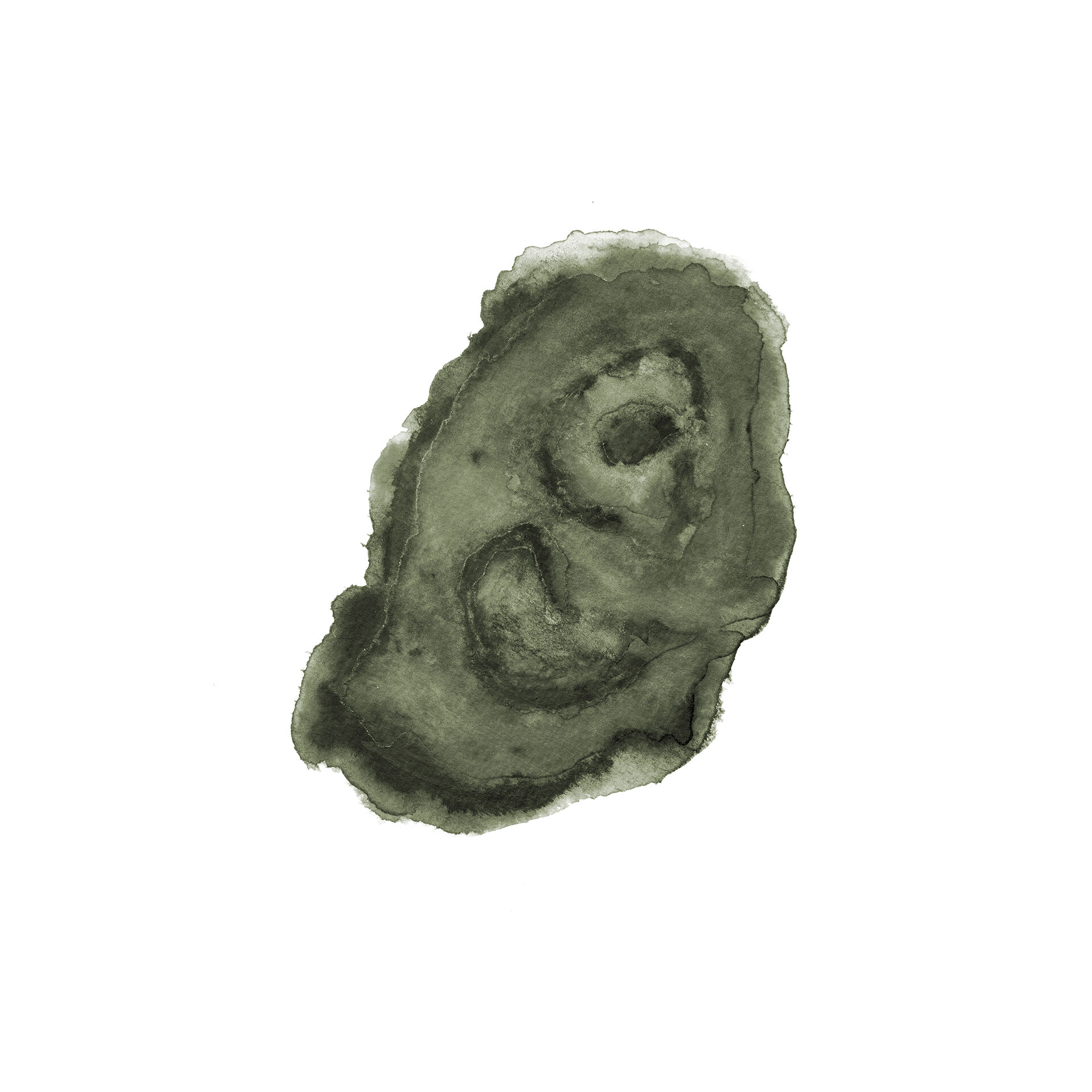 Zeichnung Ulcus Cruris